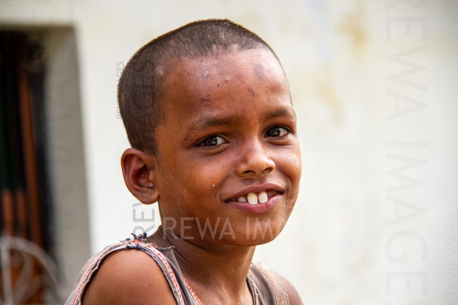 Skin disease on children near coal mining in Singrauli